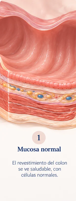 Paso 1 de la progresión de pólipo a cáncer de colon