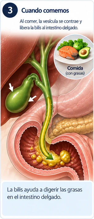 Paso 3: Al comer, se contrae. Cuando comés (sobre todo grasas), la vesícula se contrae y libera la bilis al intestino para ayudar a digerir.